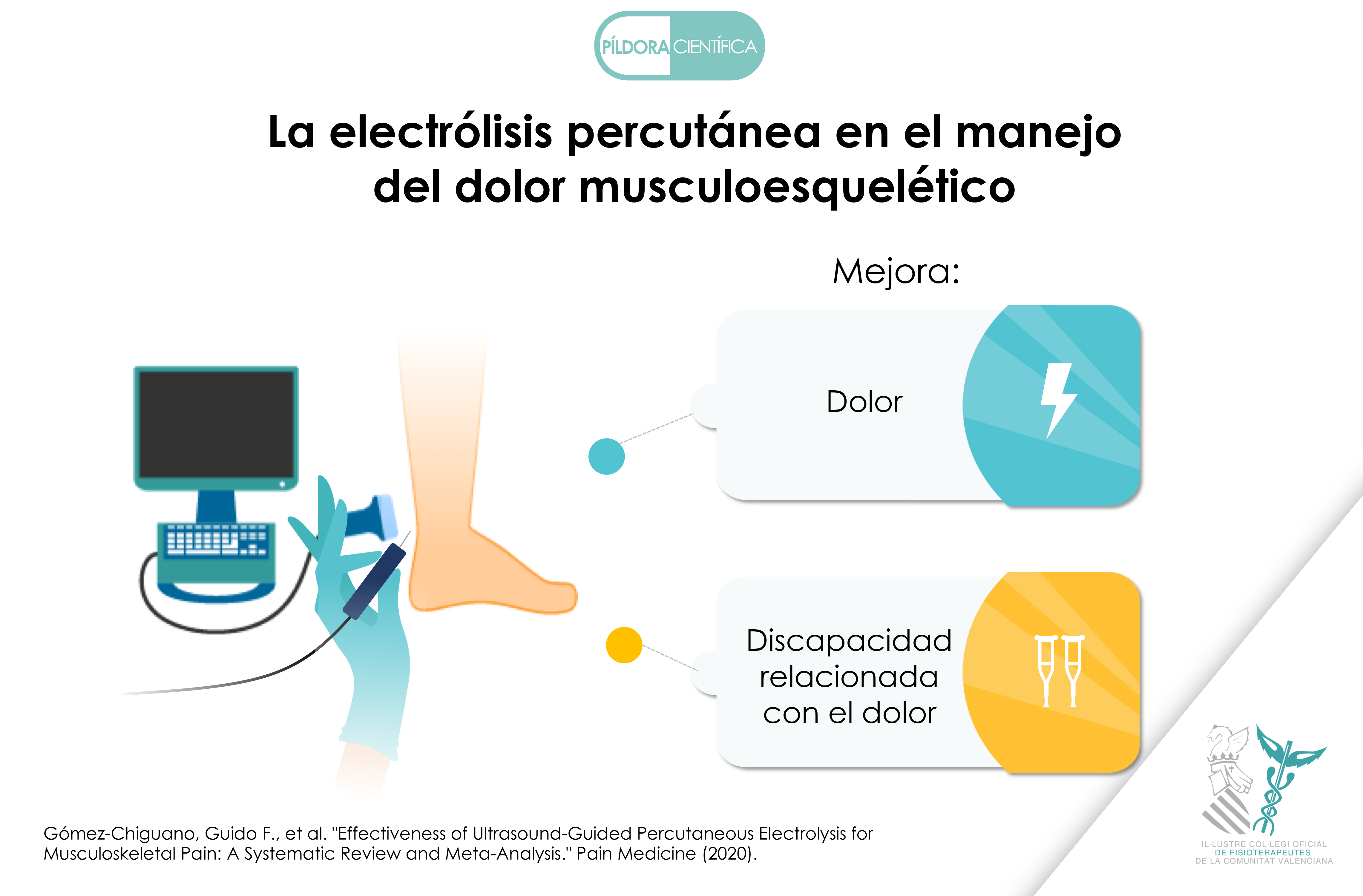 Electrólisis percutánea para el manejo del dolor musculoesquelético 