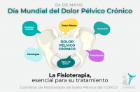 Fisioterapia, vital para hacer frente al Dolor Pélvico Crónico